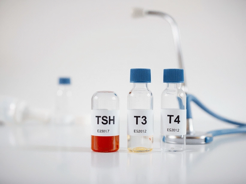 The Importance of Thyroid Function Tests: TSH and Beyond