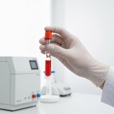 Close-up of a hand holding a test tube with a thyroid icon, representing thyroid function tests